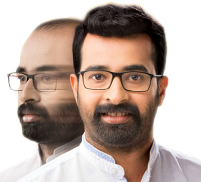 Men Hair Replacement