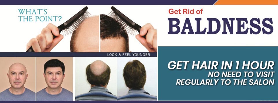 EXPERT (Innovative Cure) - hair-replacement
